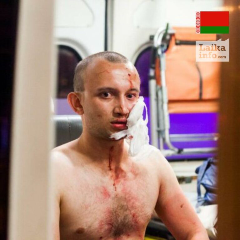 Протесты в Беларуси, есть раненные и убитые